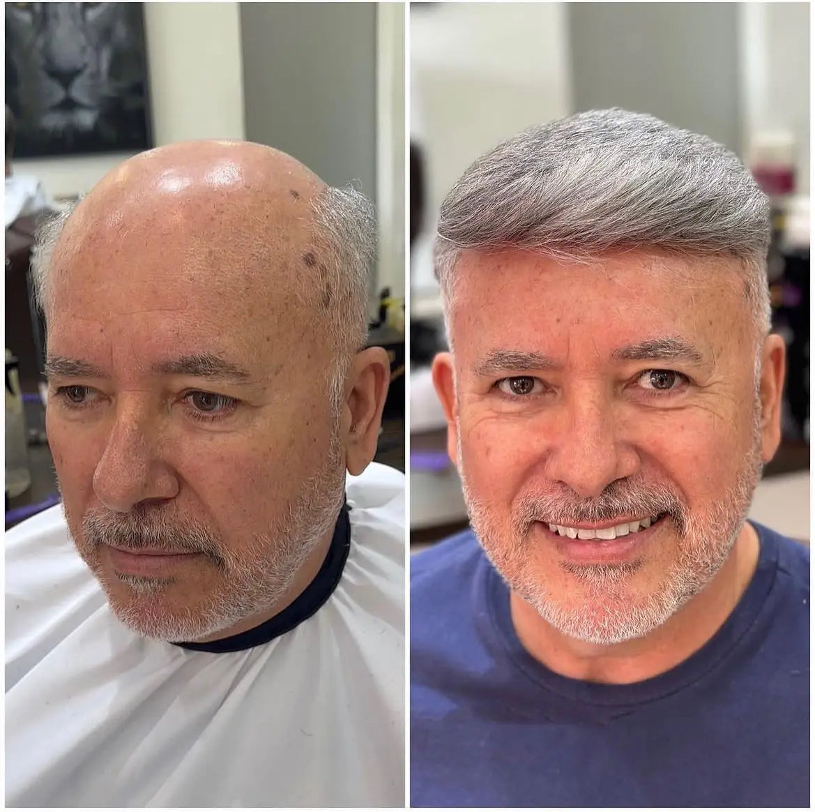 Remy Human Hair Toupee , Capillary Topper , Men's Brazilian Hair System